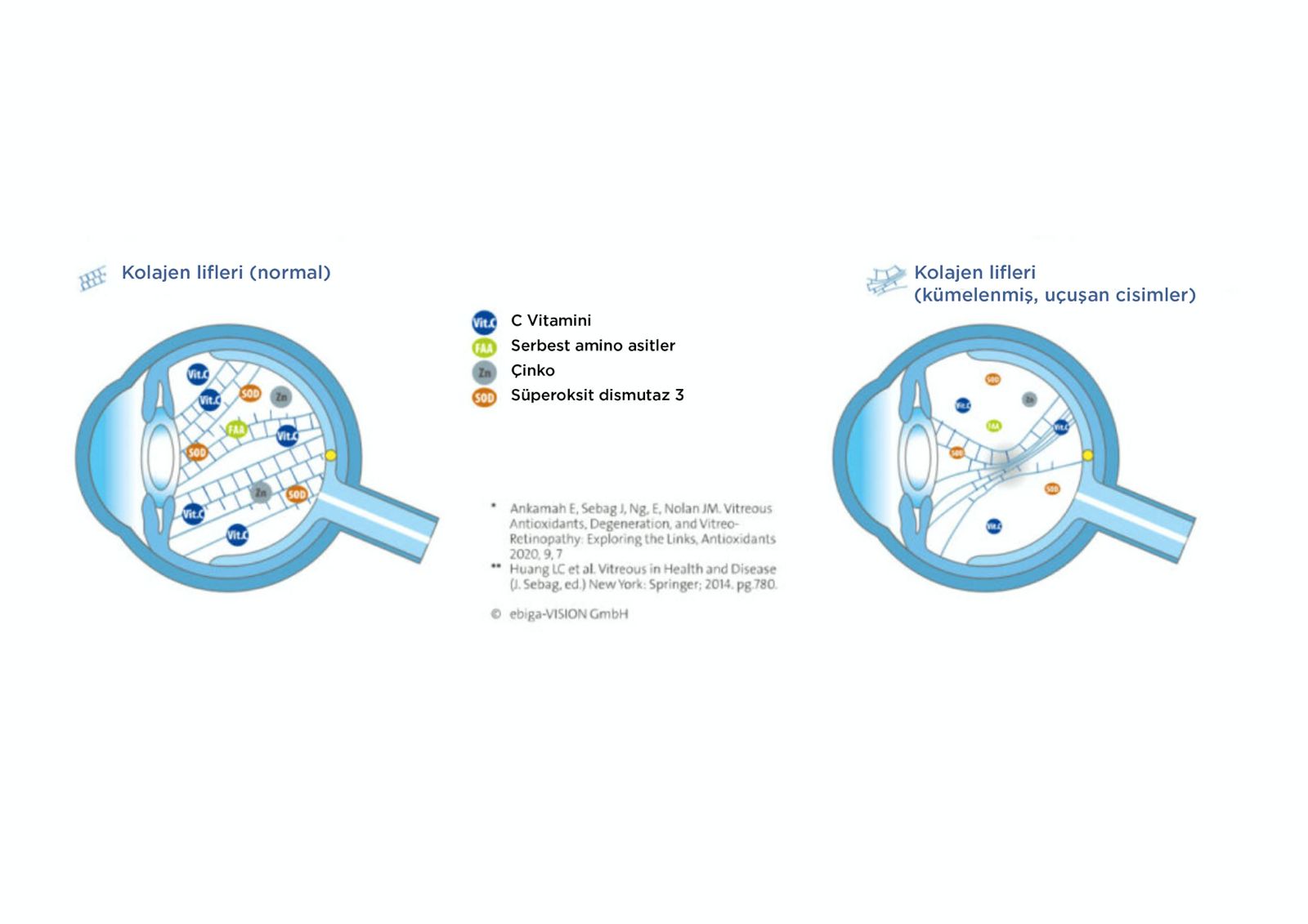 Göz uçuşmaları tedavi seçenekleri